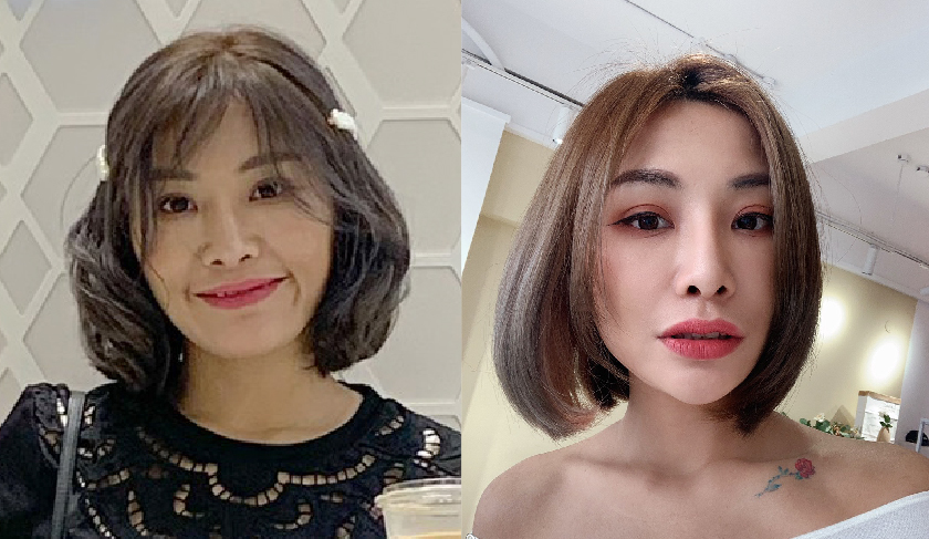星和醫美電波拉提效果